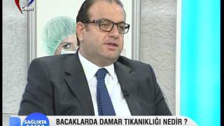 Bacaklarda Damar Tıkanıklığı ve Tedavisi Nedir [upl. by Refinnaj366]