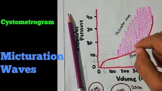 Cystometrogram  Micturition waves  Renal system 46 [upl. by Yrreg]