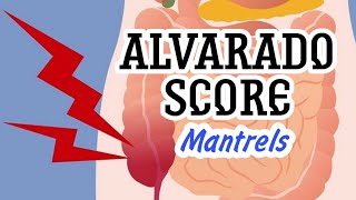 ALVARDO SCORE  MisMedicine [upl. by Ecerahs81]