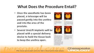 UroLift Procedure for BPH Chesapeake Urology [upl. by Yellehs]