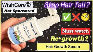 Wishcare hair growth serum Concentrate Honest Review  best hair growth amp hair fall serum wishcare [upl. by Sacks]