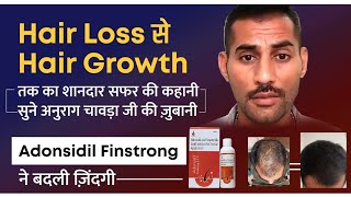 Adonsidil Finstrong Hair Regrowth Result  Hair Fall  Hair Loss  Hair Damage  Hair Transplant [upl. by Alanna]