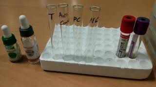 Indirect Coombs test by Tube method [upl. by Selrahcnhoj]