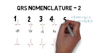 ECG QRS NOMENCLATURE [upl. by Ecirrehs822]