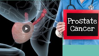 Prostate cancer ke lakshan  Prostate cancer signs in Hindi [upl. by Laikeze708]