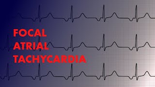 Focal Atrial Tachycardia  EKG Interpretation  MEDZCOOL [upl. by Ping]