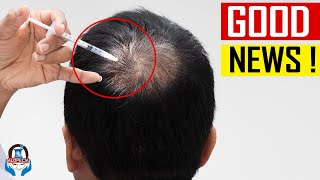 PERMANENT BALDNESS CURE ON THE WAY – RCH01 ALOPECIA TREATMENT [upl. by Ennalorac933]