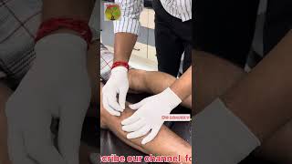 Dry needling procedure in calf myalgia chiropractor ayodhya india trending [upl. by Bonar502]