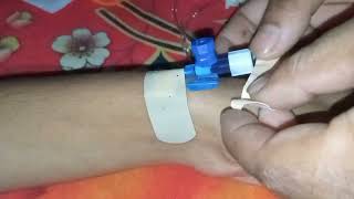 IV CannulaIntravenous Saline Pushing [upl. by Hakilam]