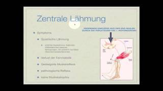 Basiskurs Neurologie Lähmungen Teil 214 [upl. by Raymond984]