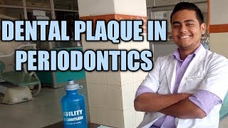 Dental Plaque in Periodontics  Periodontology [upl. by Ermanno413]