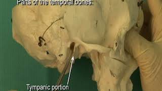 17 Step 1 Parts of the adult temporal bone petrotympanic fissure [upl. by Anivid]