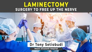 LAMINECTOMY  SURGERY FOR SPINAL STENOSIS [upl. by Aiyt]