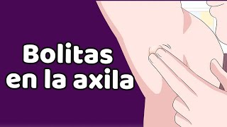 LA PROTUBERANCIA AXILAR causas síntomas tratamiento [upl. by Ylle]