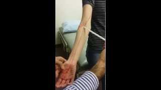 3 UL Median nerve  Course [upl. by Levania]