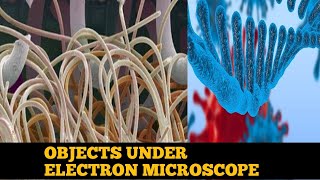 new objects under electron microscope [upl. by Kally]