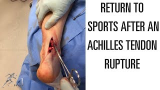 Return to sports after Achilles tendon rupture [upl. by Sutherlan164]