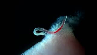 Bloodfeeding adult female Ancylostoma ceylanicum hookworm [upl. by Vigen]