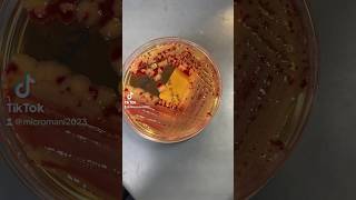 Serratia marcescens bacteria laboratory learning medtech microbiology serratia labtech [upl. by Anele813]