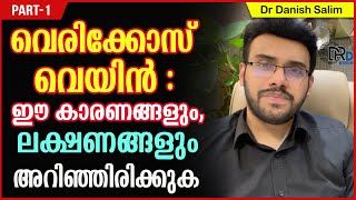 903 🛑 വെരിക്കോസ് വെയിൻ  ഈ കാരണങ്ങളും ലക്ഷണങ്ങളും അറിഞ്ഞിരിക്കുക Varicose Vein Causes amp Symptoms [upl. by Assedo]