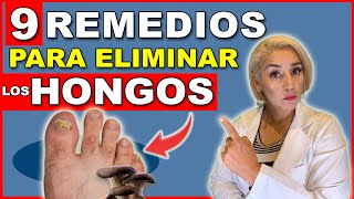 ¡Elimina HONGOS en las UÑAS en 24 HORAS  9 REMEDIOS NATURALES para HONGOS en las UÑAS 😲 [upl. by Suoicerpal]