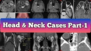 Radiology Viva Cases  367 375  Head and Neck Exam Cases Part 1 medical radiology [upl. by Kreegar513]