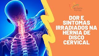 Dor e Sintomas Irradiados na Hérnia de Disco Cervical [upl. by Aurie]