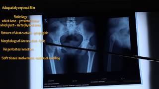 HOW TO READ XRAY PROPERLY IN ORTHOPAEDICS  MADE EASY BY DR BISHNU POKHAREL  PART 2 [upl. by Yeblehs]