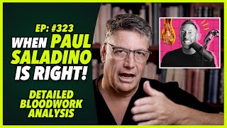 Ep323 WHEN PAUL SALADINO IS RIGHT Detailed bloodwork analysis  by Dr Robert Cywes MD PhD [upl. by Auburn]