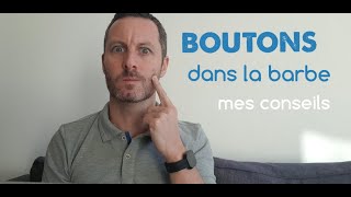 3 astuces contre les boutons dans la barbe  mes conseils [upl. by Nnaeoj]