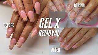 HOW TO REMOVE GEL X NAILS AT HOME [upl. by Cote]