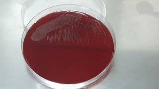 Streptococcus agalactiae colony characteristics on blood agar of Urine Culture [upl. by Namzaj]