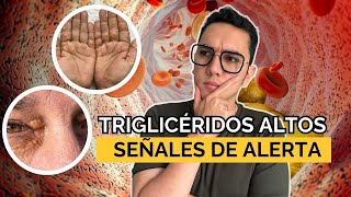 Señales de alerta de triglicéridos altos en sangre  Dr William Guerrero [upl. by Itin500]