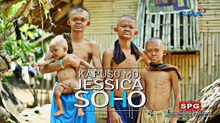 Kapuso Mo Jessica Soho The rare case of poreless skin in four siblings [upl. by Malkah]