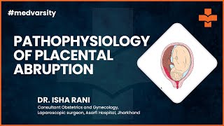 Pathophysiology of Placental Abruption  Case Discussion [upl. by Adiehsar]