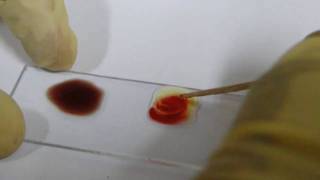 Blood Grouping Experiment  Amrita University [upl. by Ng]