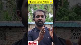 Mumps Virus Attack in TN science adda247tamil [upl. by Kcerb418]