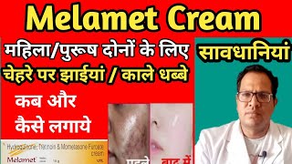 Melamet Cream  Melasma  Uses  Side effects  Review  Melamet Cream Remove Pigmentation [upl. by Nalid]