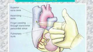 34 Transverse sinus of pericardium [upl. by Odin785]