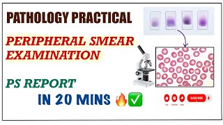 Peripheral Blood Smear  PS Examination  PATHOLOGY PRACTICALS  In Hindi  Simplest Way ✅ [upl. by Senn]