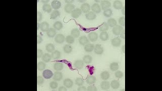 Aula 5 Trypanosoma [upl. by Ahsemak141]