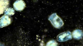 Protozoa Vorticella video [upl. by Ahsenra]