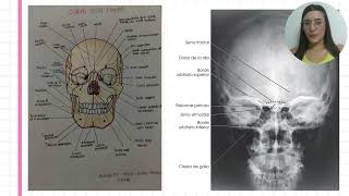 Cráneo  Comparación [upl. by Niwroc]