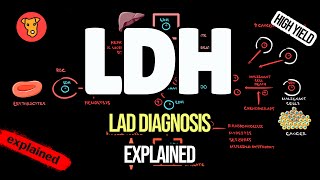 LACTATE DEHYDROGENASE Clinical significance Why LDH increase [upl. by Phillipp43]