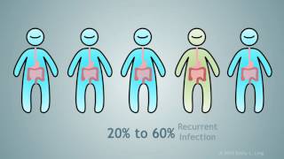 Fecal Microbial Transplantation A Treatment for Clostridium Difficile [upl. by Blayne114]