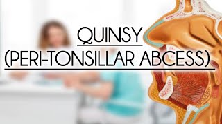 QUINSY PERITONSILLAR ABCESS [upl. by Bourn819]