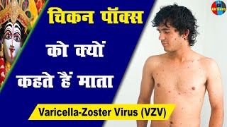 Chickenpox  Monkeypox  Eccgema  Psoriasis  Herpes  Urticaria चिकनपॉक्स Health [upl. by Yetty579]