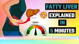 The Shocking Fatty Liver Truth EXPERTS Are Hiding [upl. by Droc]