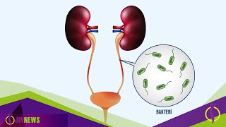 İdrar yolu enfeksiyonundan nasıl korunmalı [upl. by Nesaj]