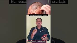 Psoriasis treatment in tamil Dr Balajimuthu [upl. by Aniahs]